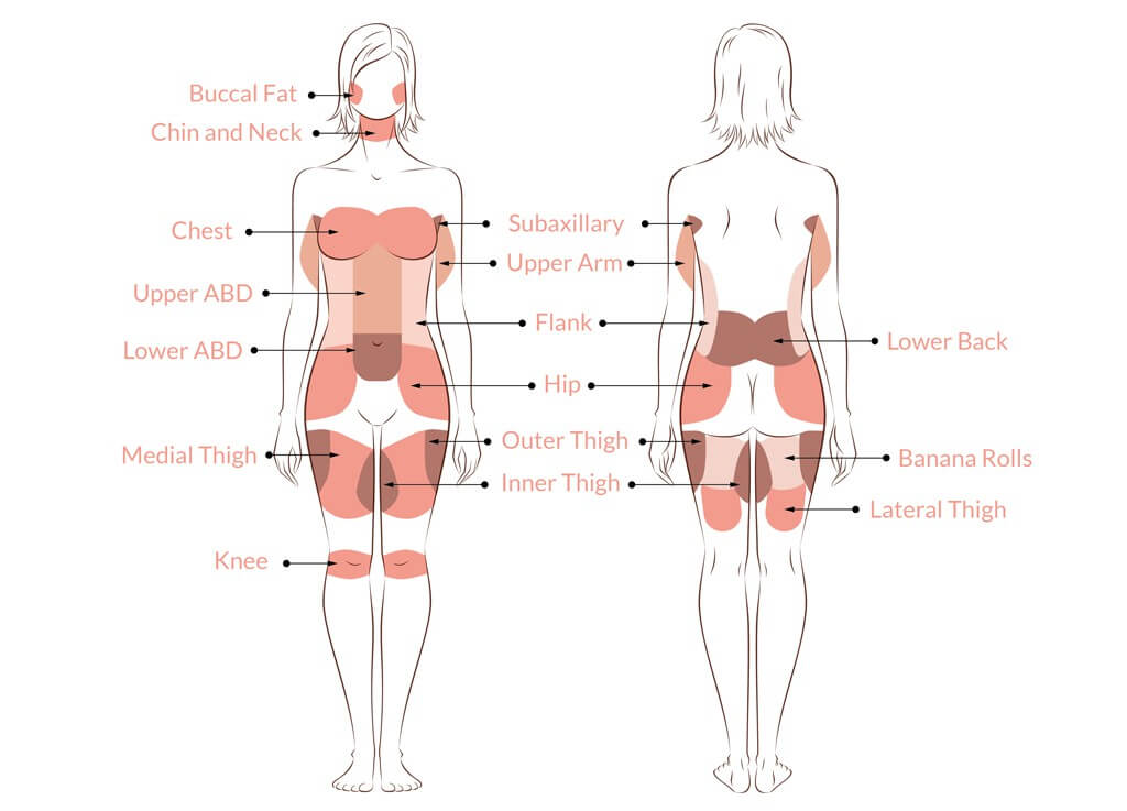 Possible MyBreast Liposuction Sites